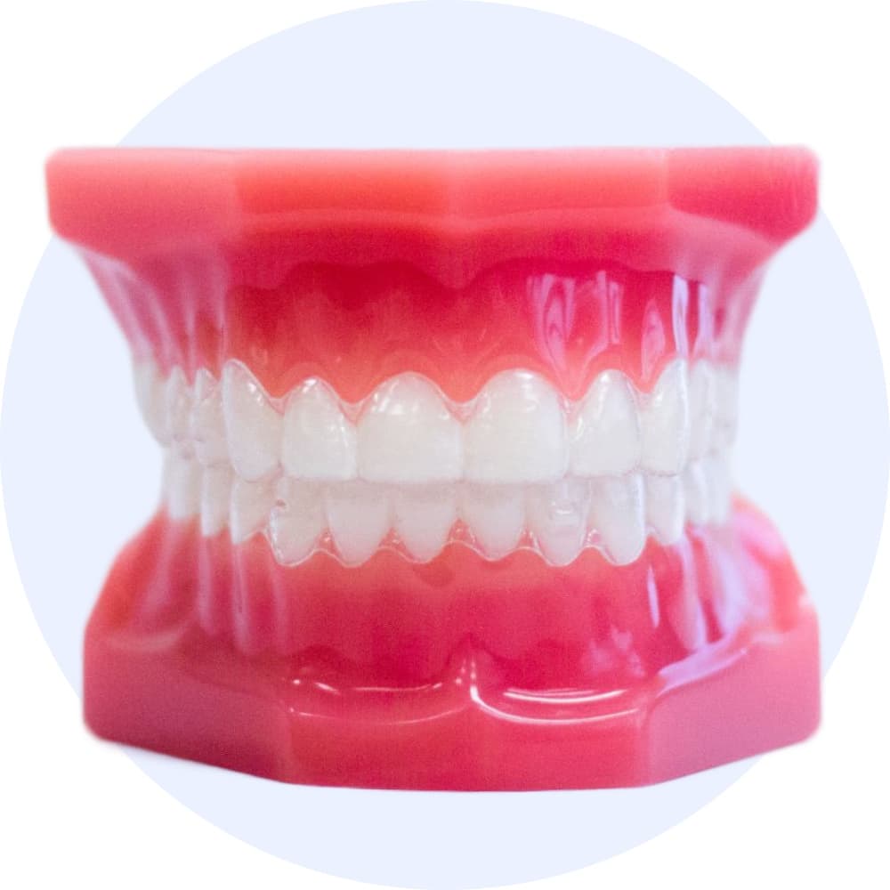 invisalign aligners on model