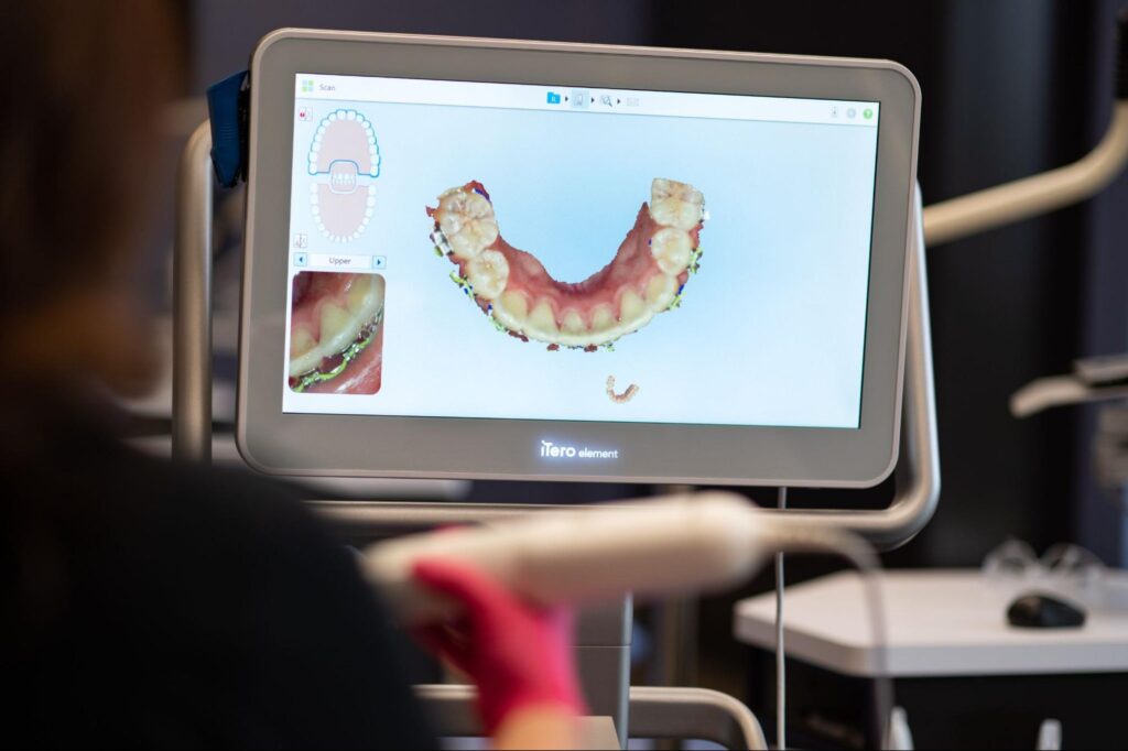 How Do X-Rays Track Orthodontic Progress?
