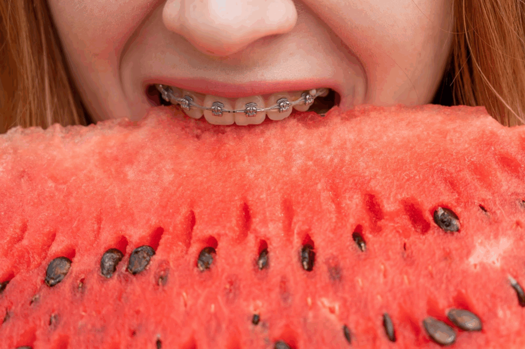What to Eat With Braces