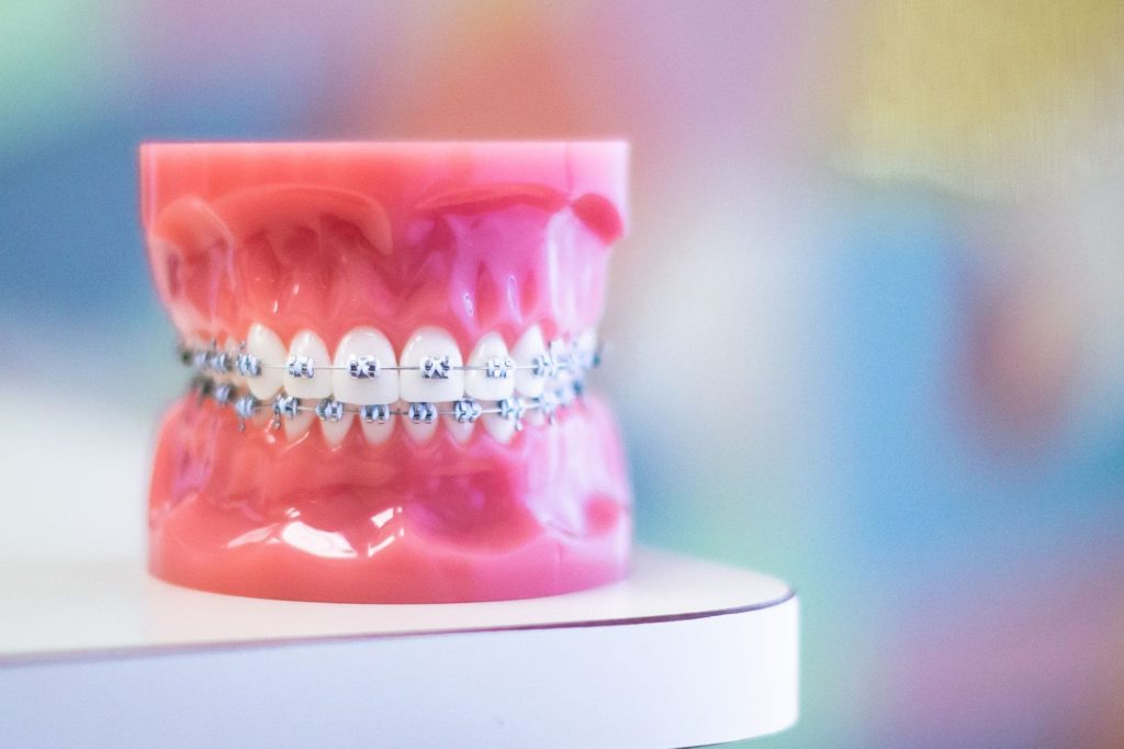 graham orthodontics metal braces