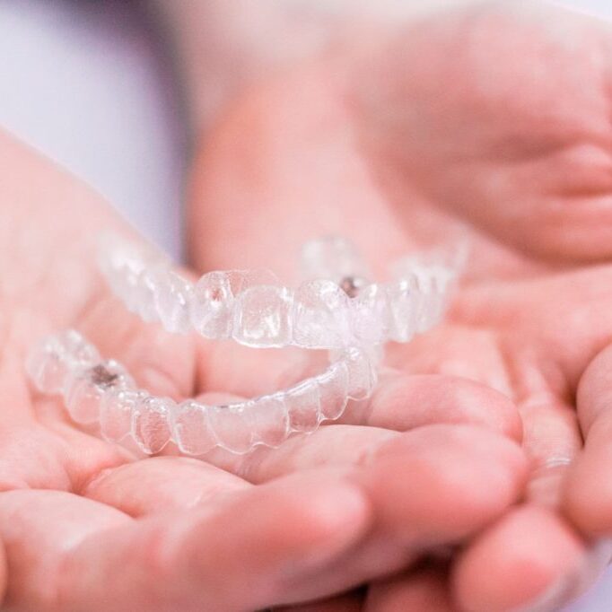 Invisalign Clear Braces in Burlington ON - Orthodontic Treatment